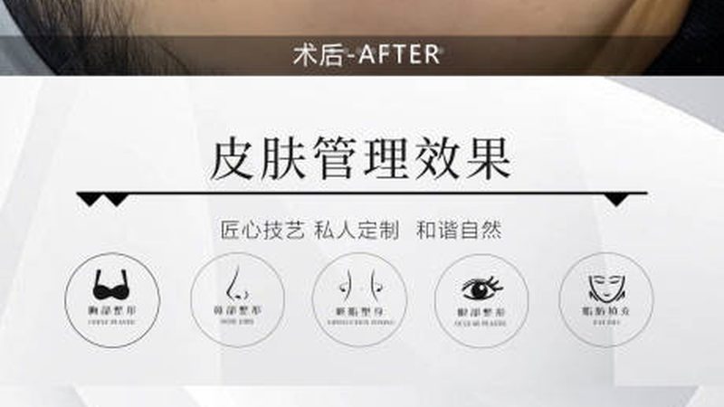 整形美容合同退款条款的五大关键要素