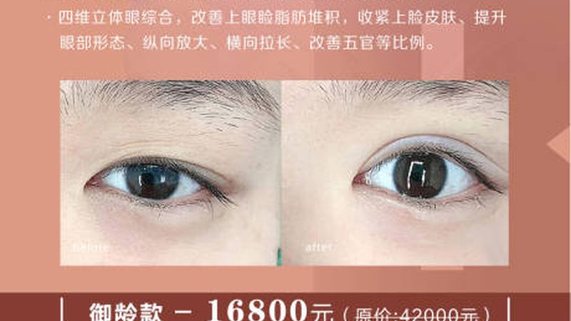 医美术后恢复，这些细节你注意到了吗？**
