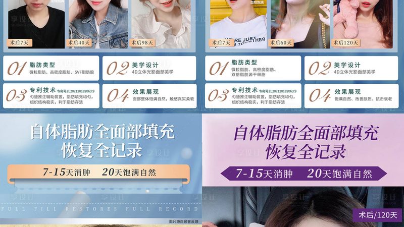 医美加盟投资预算：揭秘加盟前的关键考量