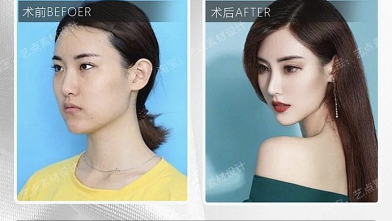 医美咨询师新手实战技巧：如何精准把握客户需求