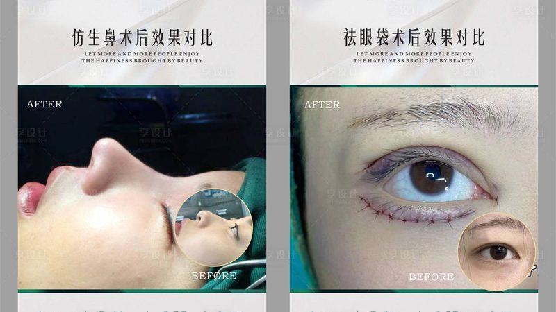 医美咨询师培训，价格之外，你更需要了解这些**