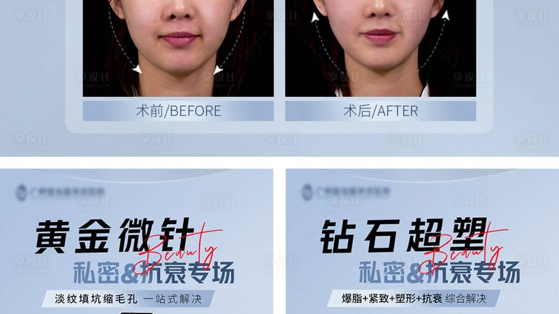 国产瘦脸针与进口瘦脸针：成分差异与选择指南