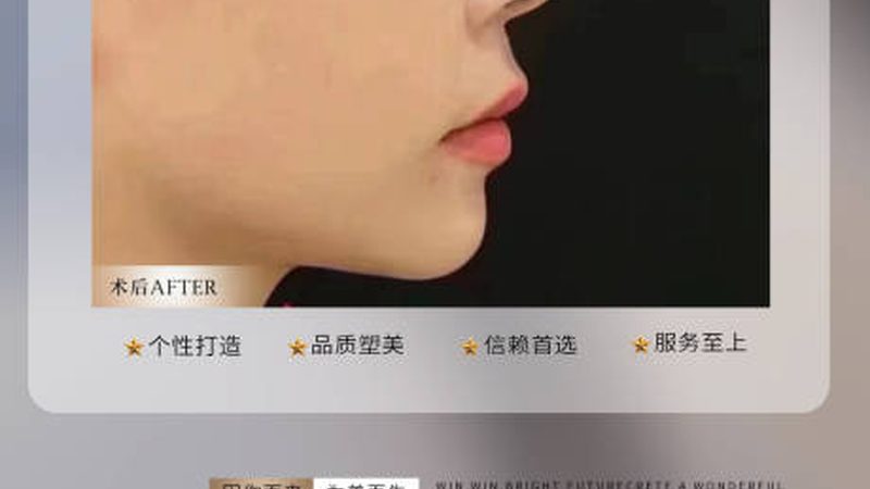 玻尿酸与自体脂肪填充：面部年轻化的两种选择