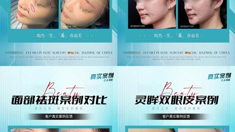 热玛吉2025：揭秘价格背后的技术秘密