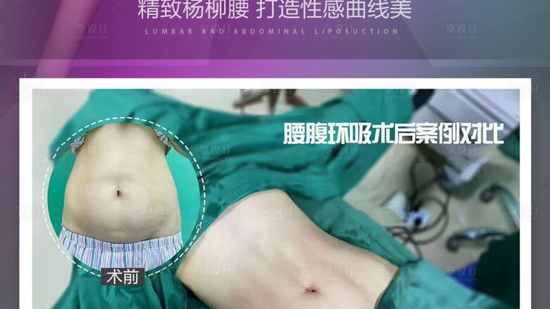 整形美容术后恢复期，这些禁忌事项你了解吗？**