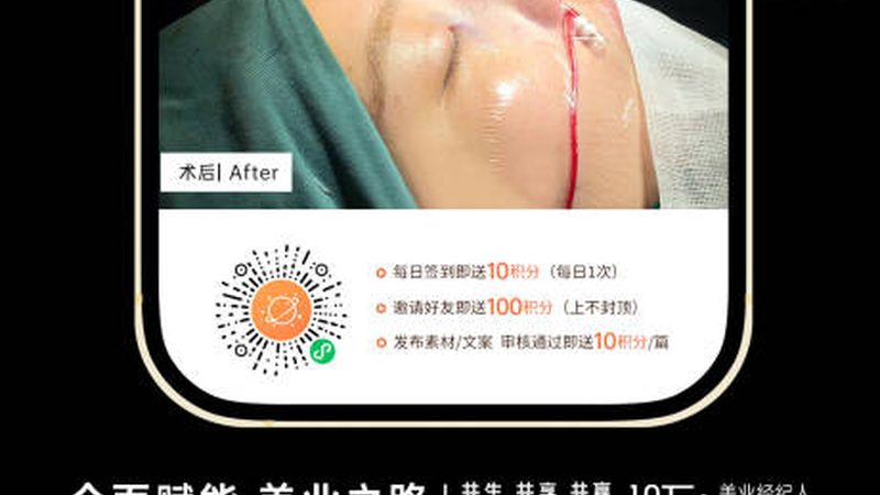 热玛吉官方授权机构查询，揭秘如何甄别真伪