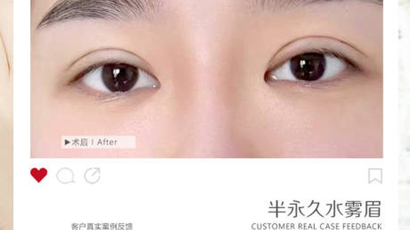 揭秘轻医美医院排名：北京前十名的优缺点解析