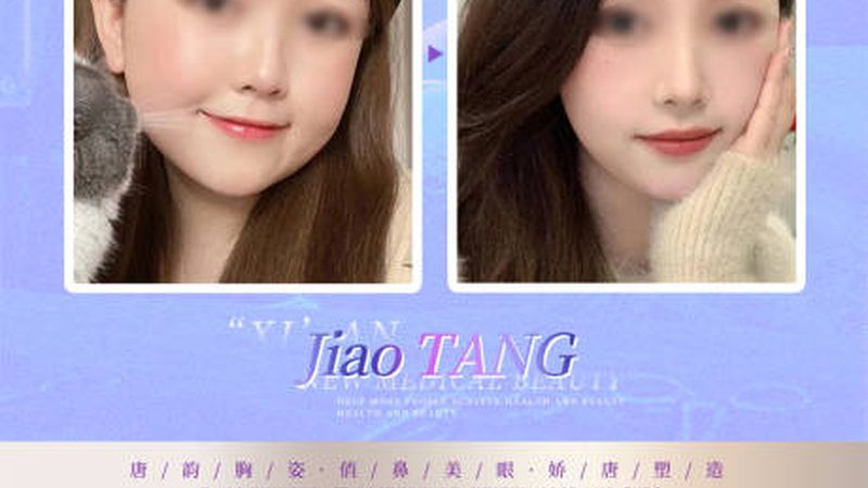 超声炮与热玛吉：揭秘美容界的双剑客**