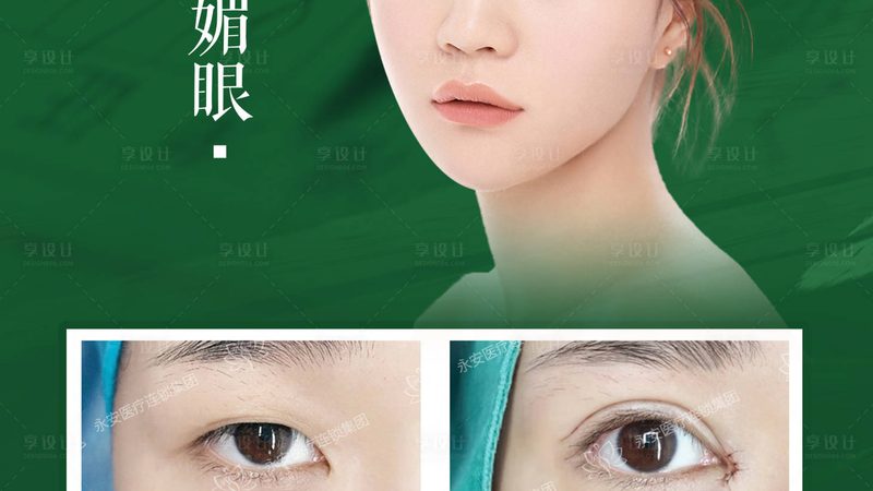 皮肤管理仪器定制怎么选厂家