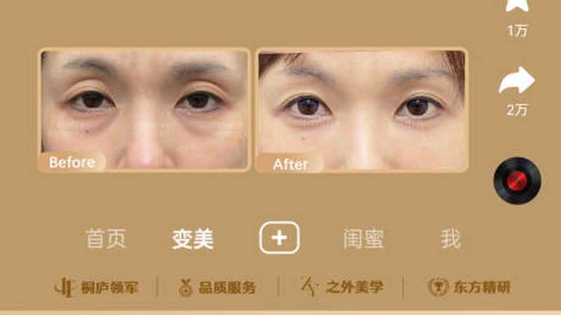 超声炮美容仪：揭秘其代理加盟费用背后的秘密**