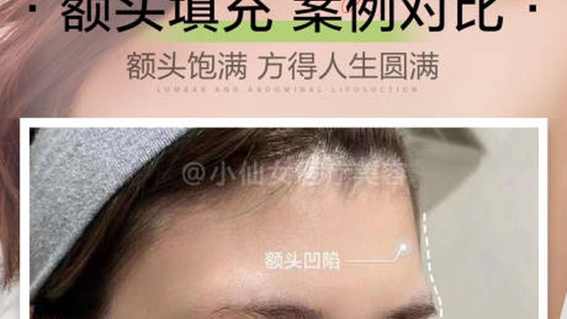 轻医美加盟与自营：两种模式背后的运营逻辑